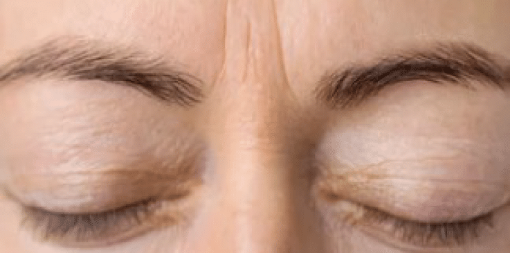 prime dental aestetics eyes